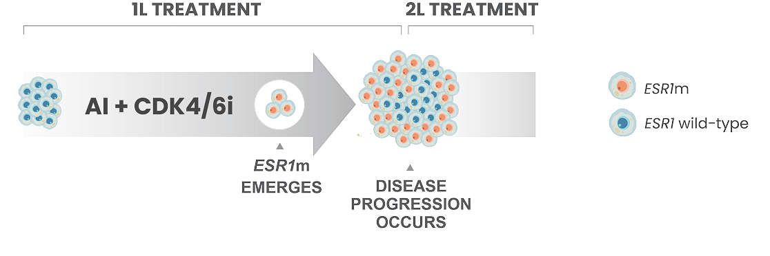 ETCAMAH + CDK4/6i vs AI in ESR1m+ HR+ mBC